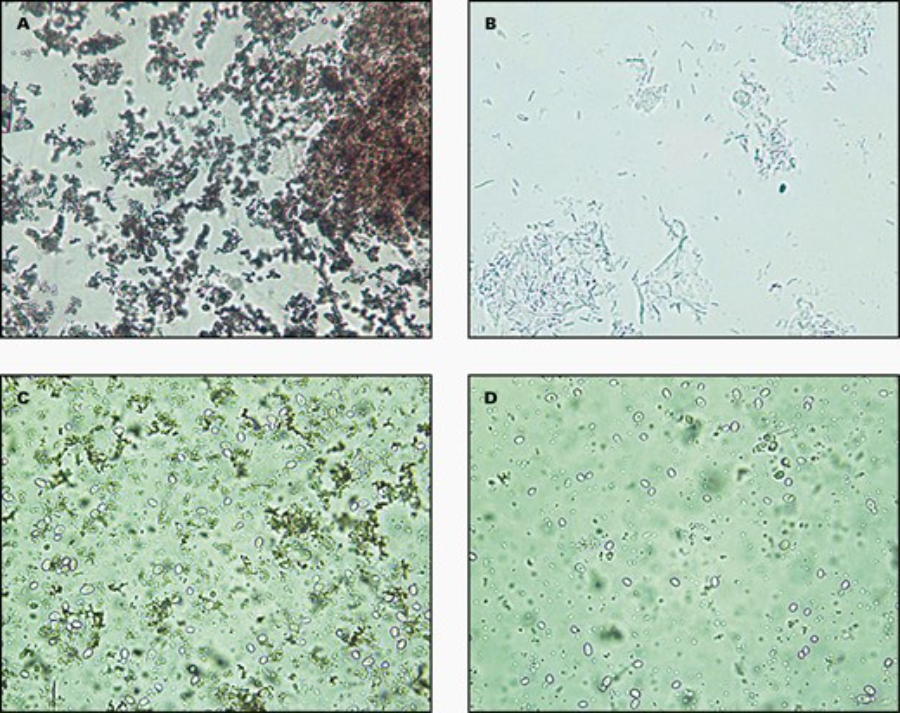 溶解尿液中无定形尿酸盐晶体的方案