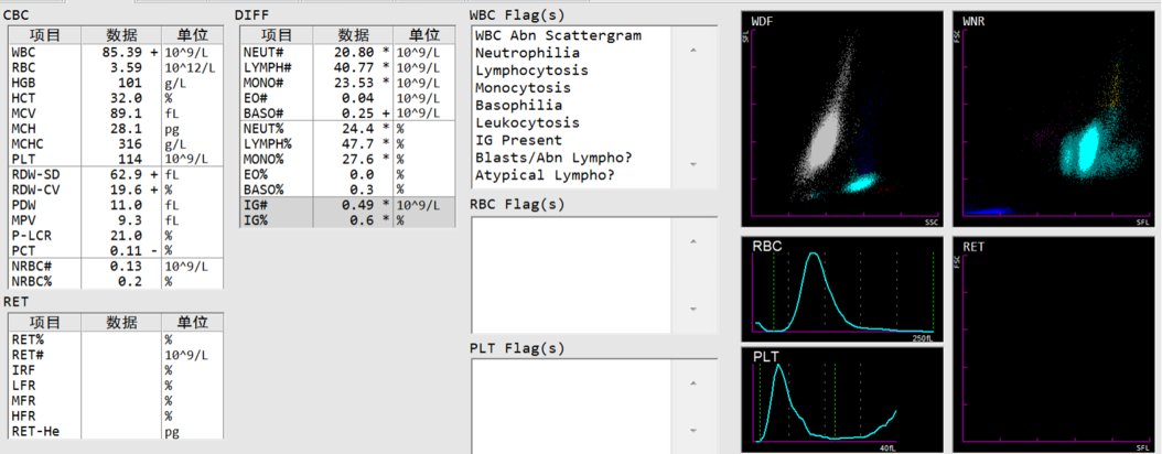 病例分享 | 一例变异型毛细胞白血病的发现之旅