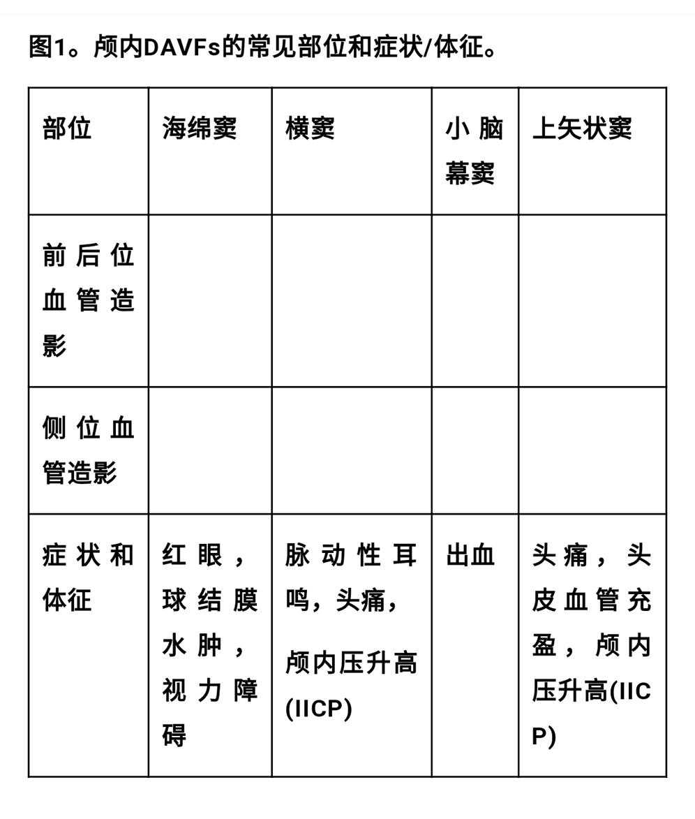 伽玛刀放射外科治疗硬脑膜动静脉瘘